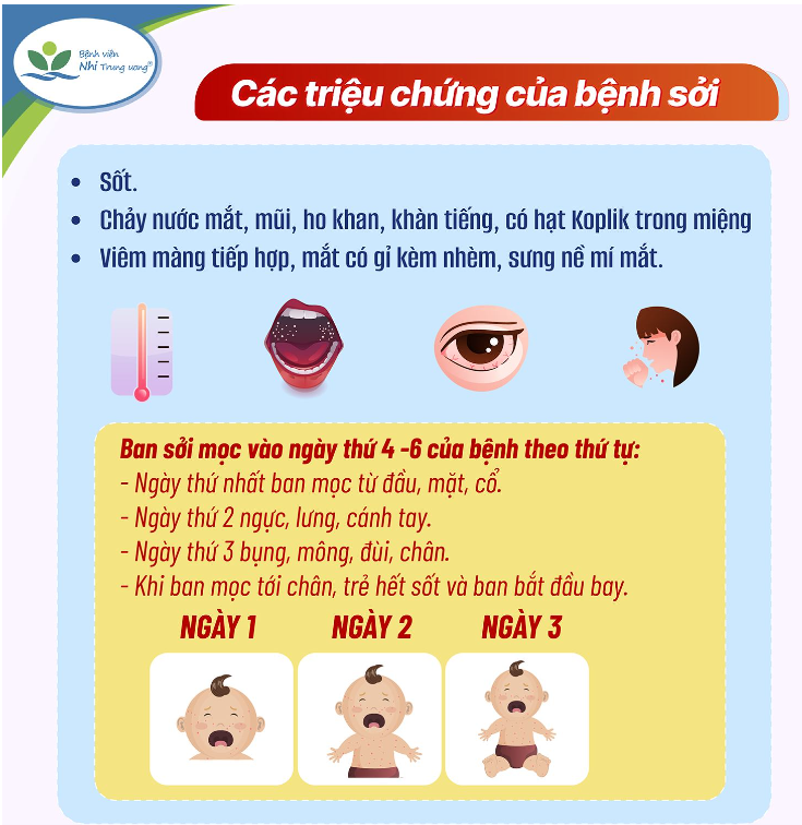 sởi 2